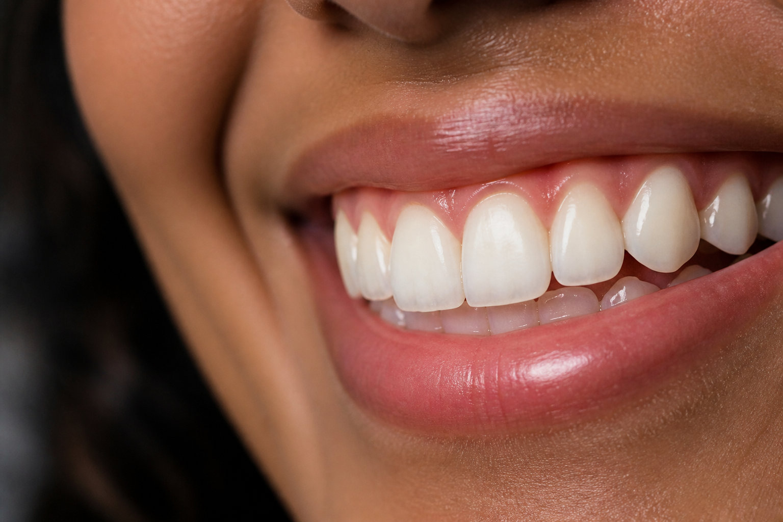 Comment avoir les dents blanches : comprendre les mécanismes de coloration
