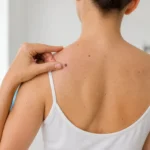 Auto examen de la peau surveillance des grains de beaute