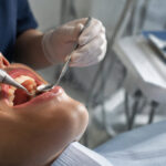 Un dentiste en gants procède à un détartrage avec un miroir et un instrument ultrasonique sur un patient allongé.